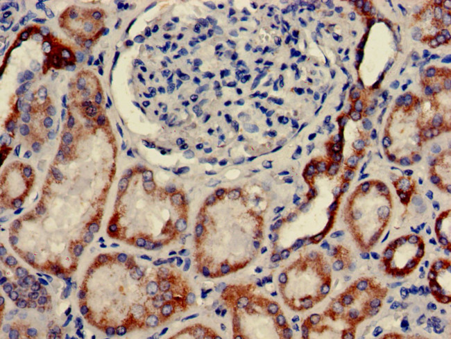 CLEC18A Antibody in Immunohistochemistry (Paraffin) (IHC (P))