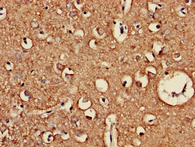 CLEC3A Antibody in Immunohistochemistry (Paraffin) (IHC (P))