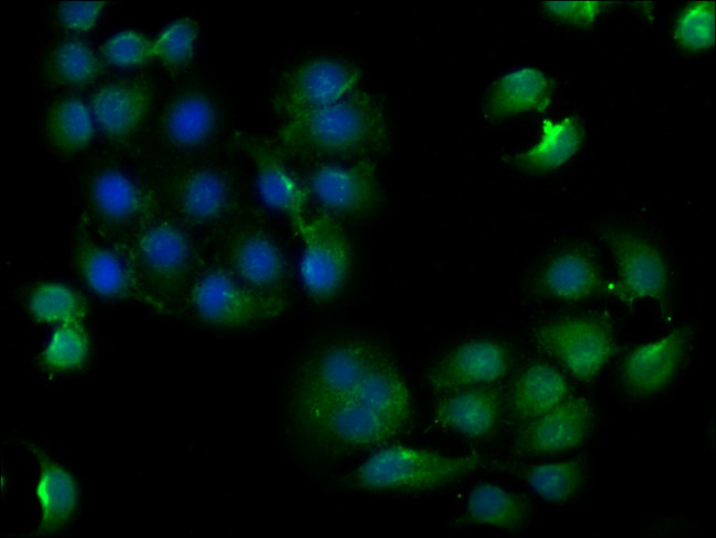 CLTCL1 Antibody in Immunocytochemistry (ICC/IF)