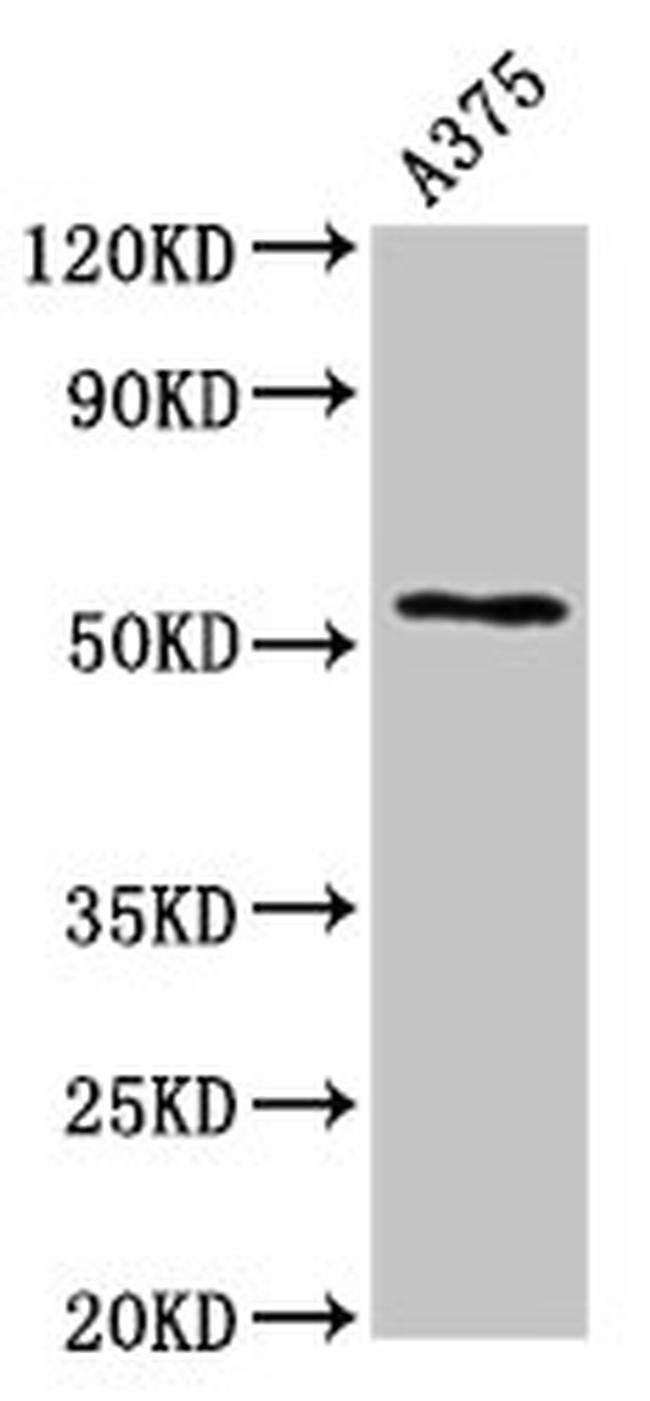 Carboxypeptidase E Antibody in Western Blot (WB)