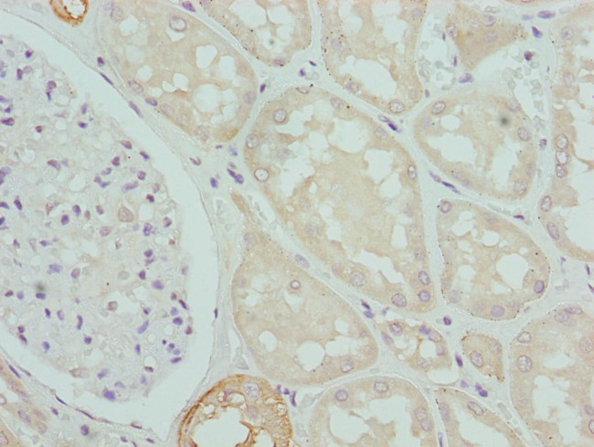 CPN1 Antibody in Immunohistochemistry (Paraffin) (IHC (P))