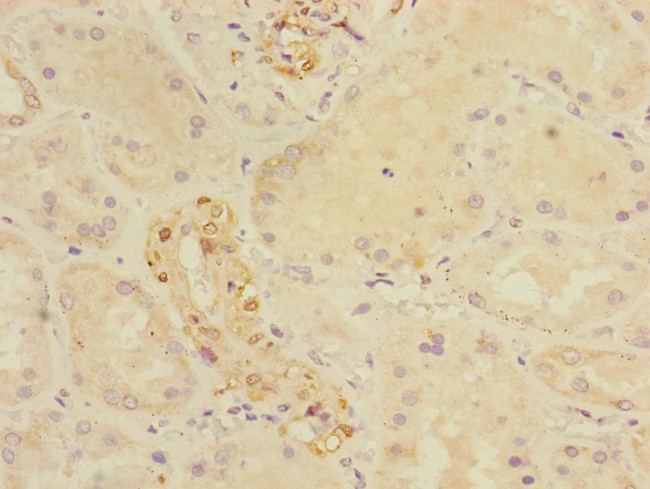 CRIP1 Antibody in Immunohistochemistry (Paraffin) (IHC (P))
