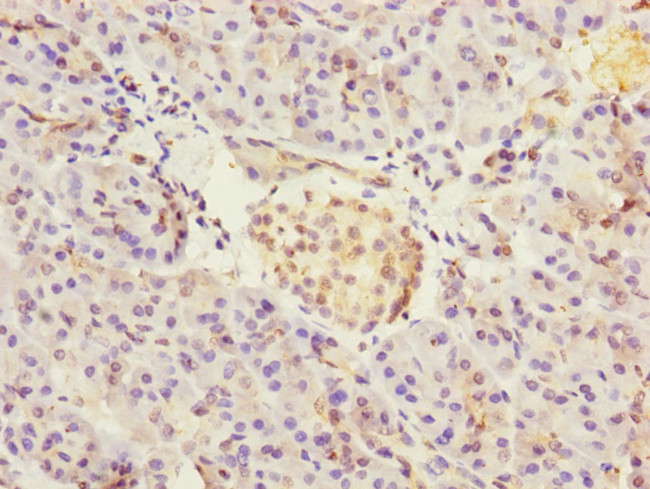 CRIP2 Antibody in Immunohistochemistry (Paraffin) (IHC (P))