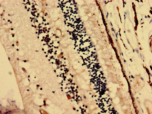 CRYBA4 Antibody in Immunohistochemistry (Paraffin) (IHC (P))