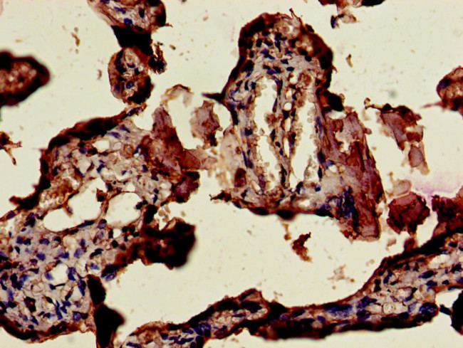 CSHL1 Antibody in Immunohistochemistry (Paraffin) (IHC (P))