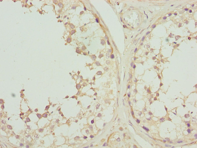 CK1 gamma-2 Antibody in Immunohistochemistry (Paraffin) (IHC (P))