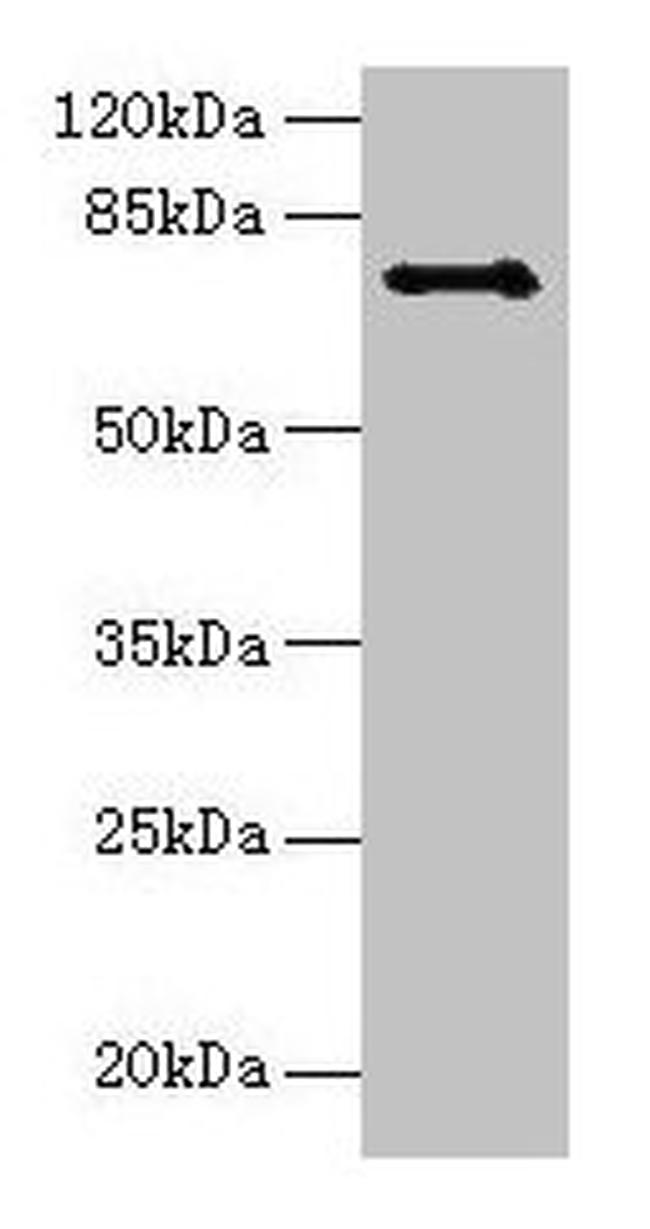 CTCFL Antibody in Western Blot (WB)