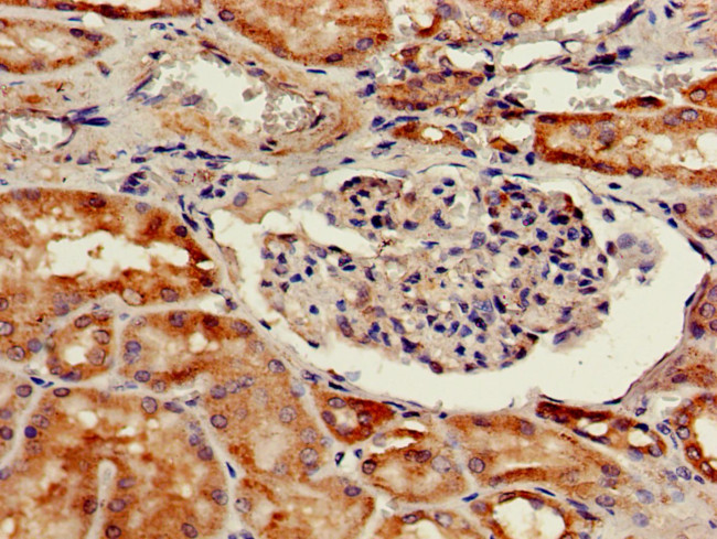 Cathepsin H Antibody in Immunohistochemistry (Paraffin) (IHC (P))