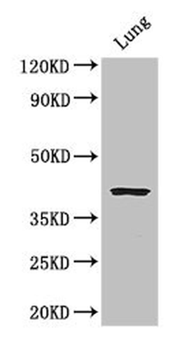 CYSLTR1 Antibody in Western Blot (WB)