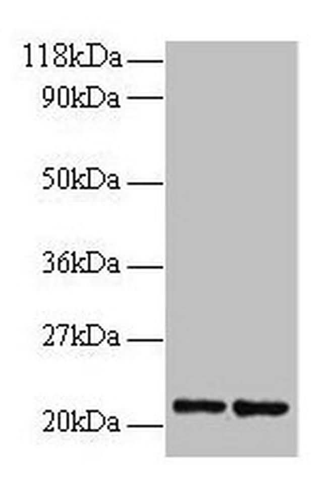 RPS9 Antibody in Western Blot (WB)