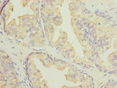 DNALI1 Antibody in Immunohistochemistry (Paraffin) (IHC (P))