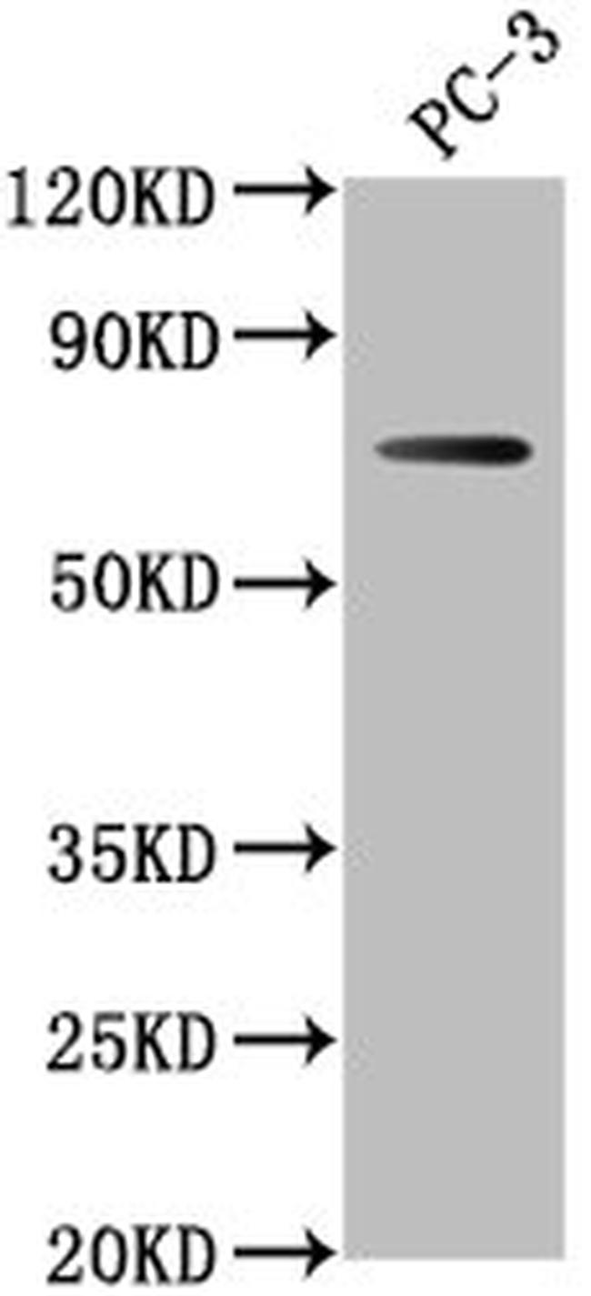 DVL1P1 Antibody in Western Blot (WB)