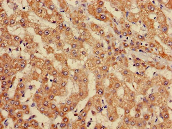 EBI3 Antibody in Immunohistochemistry (Paraffin) (IHC (P))