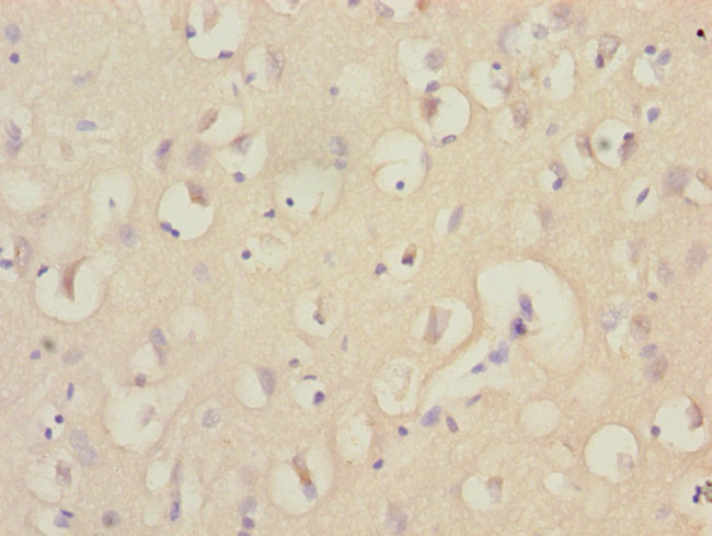 EEF1A2 Antibody in Immunohistochemistry (Paraffin) (IHC (P))