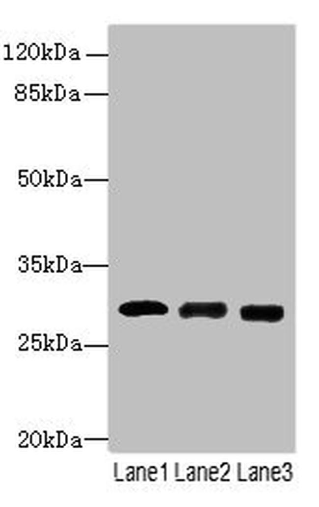 ELA3A Antibody in Western Blot (WB)