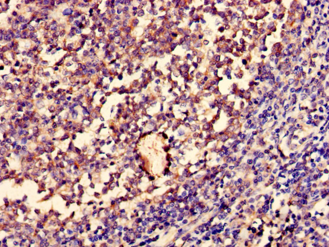 ENOX1 Antibody in Immunohistochemistry (Paraffin) (IHC (P))