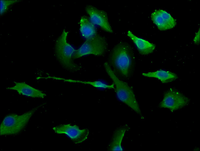 ERC1 Antibody in Immunocytochemistry (ICC/IF)
