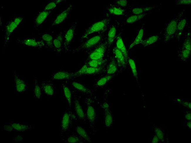 ESRP2 Antibody in Immunocytochemistry (ICC/IF)