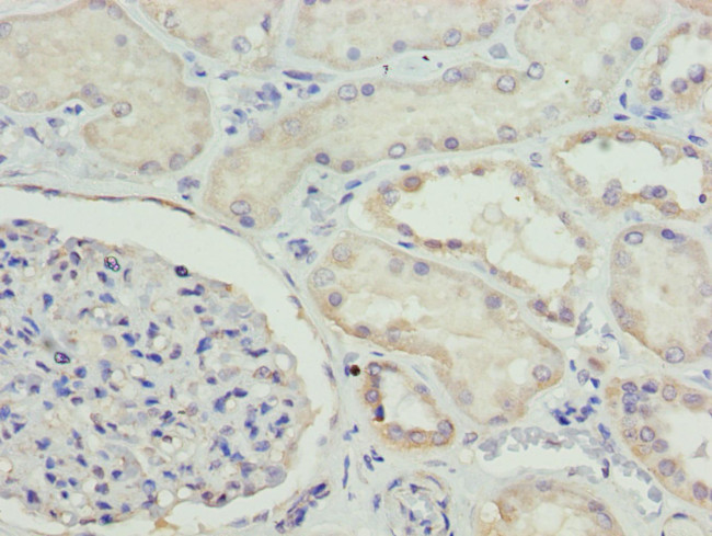 ETFA Antibody in Immunohistochemistry (Paraffin) (IHC (P))