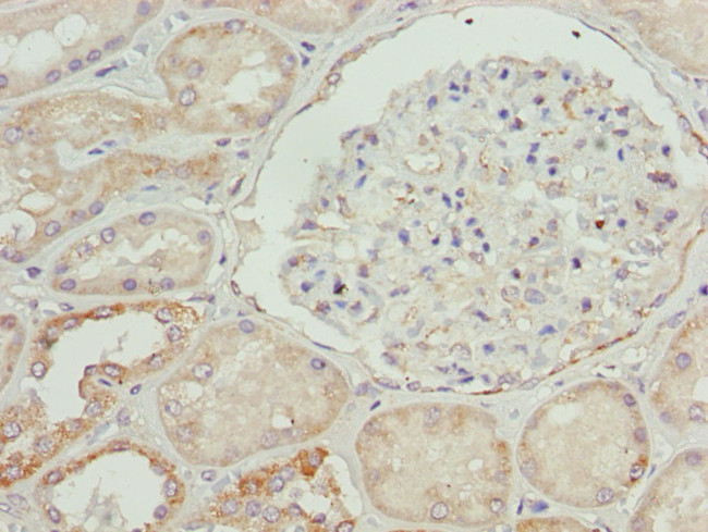 ETFA Antibody in Immunohistochemistry (Paraffin) (IHC (P))