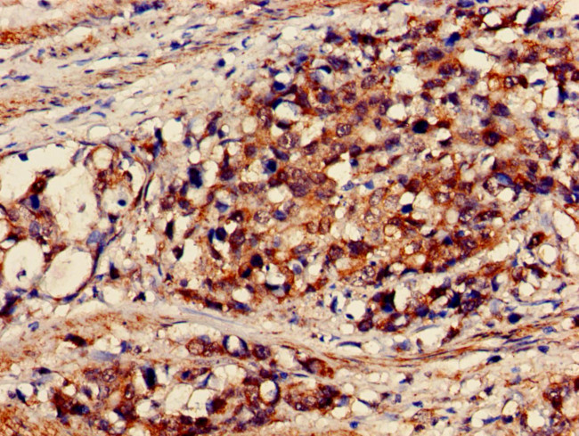 EXO1 Antibody in Immunohistochemistry (Paraffin) (IHC (P))