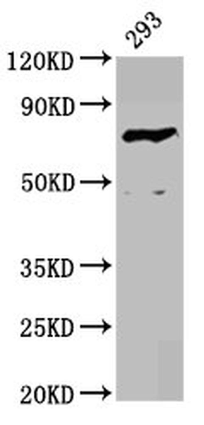 Factor XIII B Antibody in Western Blot (WB)