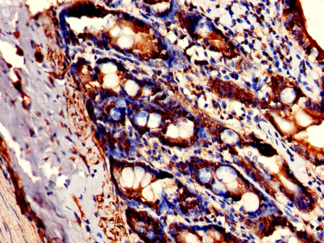 FAM3B Antibody in Immunohistochemistry (Paraffin) (IHC (P))