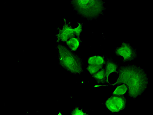 FANCC Antibody in Immunocytochemistry (ICC/IF)