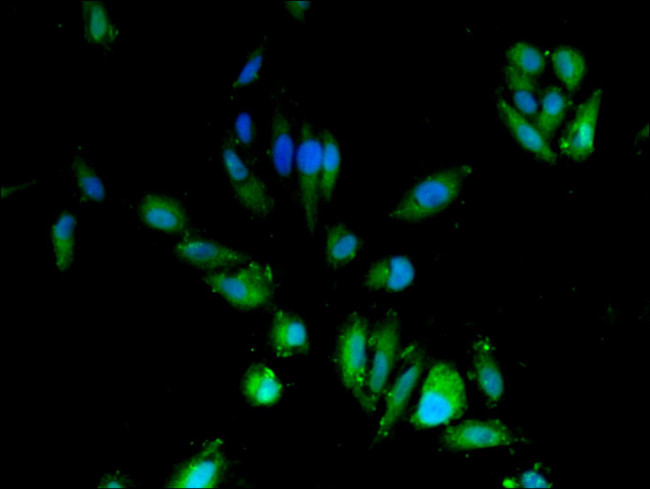 CDA Antibody in Immunocytochemistry (ICC/IF)