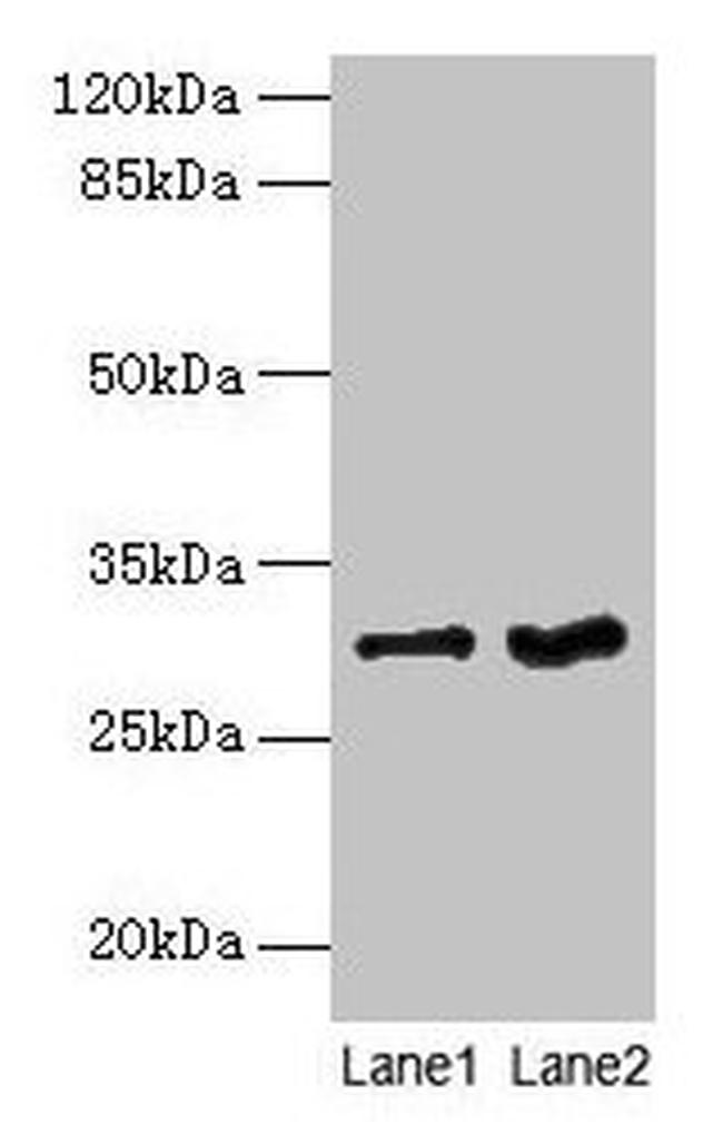 FGFR1OP2 Antibody in Western Blot (WB)