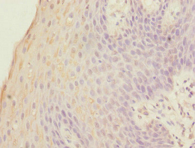 FOXP1 Antibody in Immunohistochemistry (Paraffin) (IHC (P))