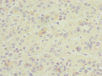 GDAP1 Antibody in Immunohistochemistry (Paraffin) (IHC (P))