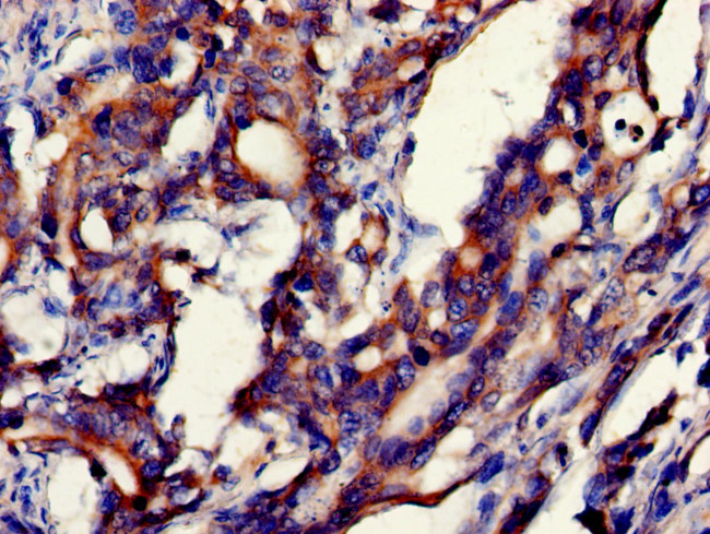 GDI2 Antibody in Immunohistochemistry (Paraffin) (IHC (P))