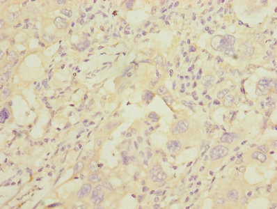 GGTLC2 Antibody in Immunohistochemistry (Paraffin) (IHC (P))