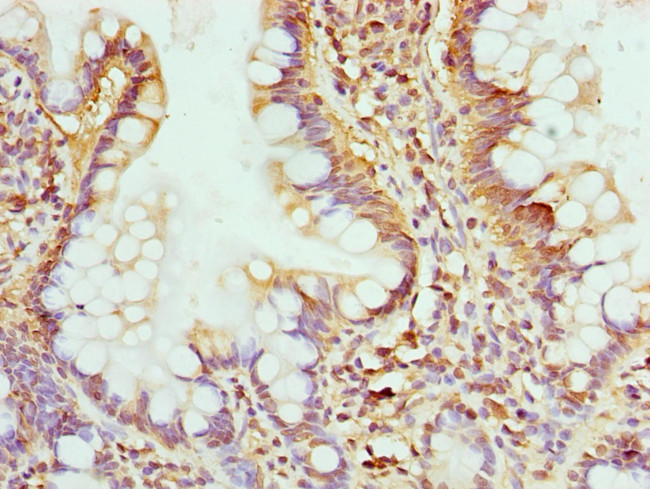 GMPS Antibody in Immunohistochemistry (Paraffin) (IHC (P))