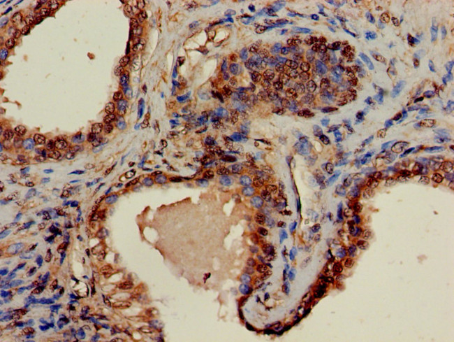 GNA14 Antibody in Immunohistochemistry (Paraffin) (IHC (P))