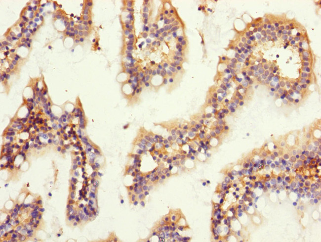 GNB2 Antibody in Immunohistochemistry (Paraffin) (IHC (P))