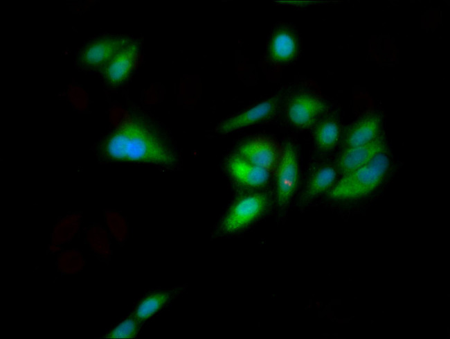 GNL1 Antibody in Immunocytochemistry (ICC/IF)