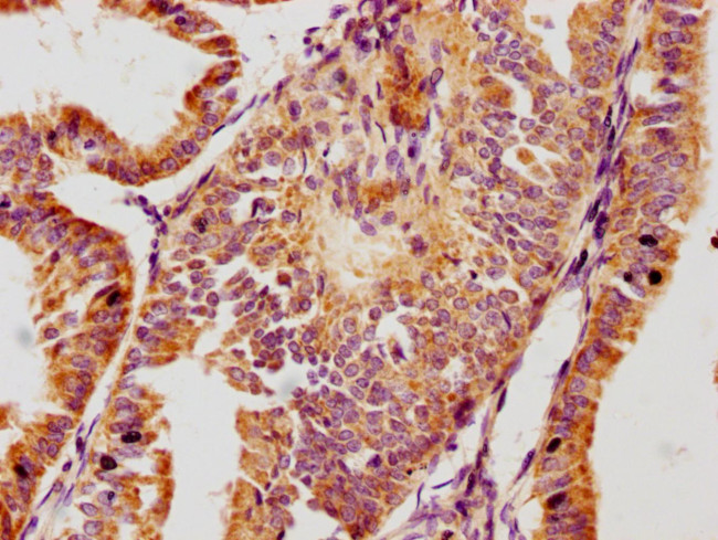 GPLD1 Antibody in Immunohistochemistry (Paraffin) (IHC (P))