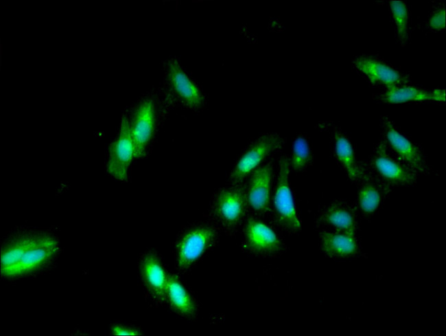 PP2A beta Antibody in Immunocytochemistry (ICC/IF)