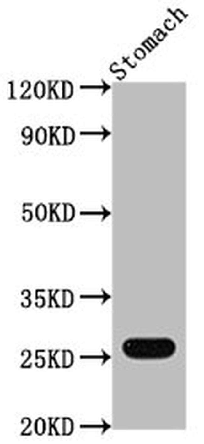 GSTA1 Antibody in Western Blot (WB)