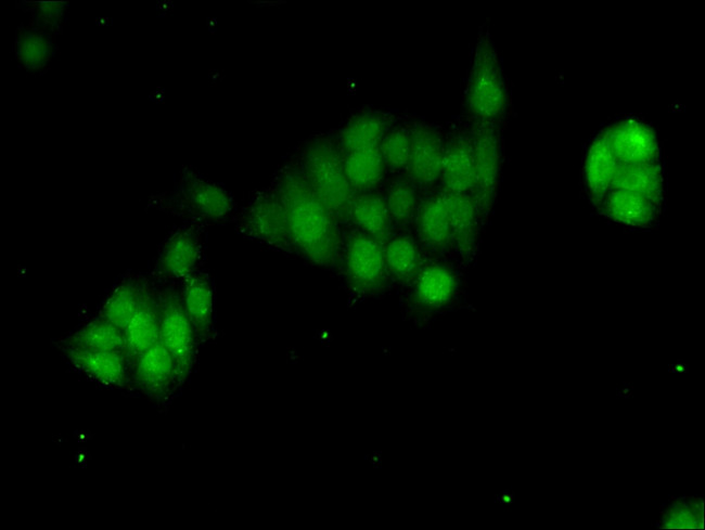 GTF2B Antibody in Immunocytochemistry (ICC/IF)