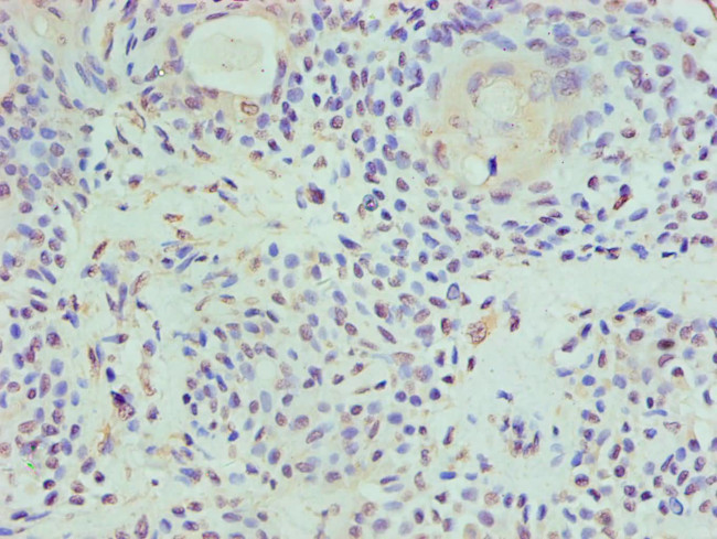 HAT1 Antibody in Immunohistochemistry (Paraffin) (IHC (P))