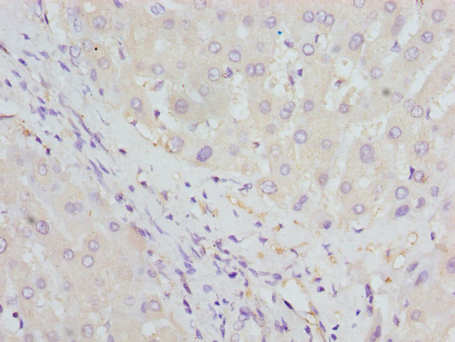 HBZ Antibody in Immunohistochemistry (Paraffin) (IHC (P))