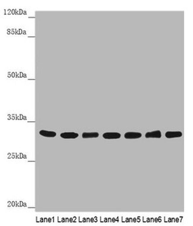 HCCS Antibody in Western Blot (WB)