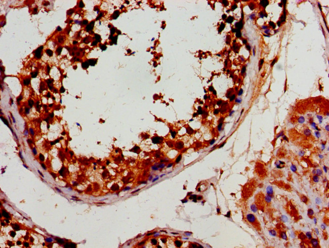 HEXIM2 Antibody in Immunohistochemistry (Paraffin) (IHC (P))