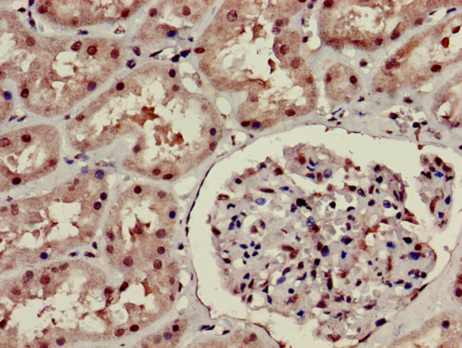 HOXA6 Antibody in Immunohistochemistry (Paraffin) (IHC (P))