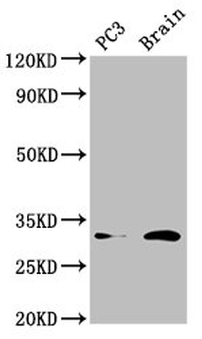 HOXD8 Antibody in Western Blot (WB)