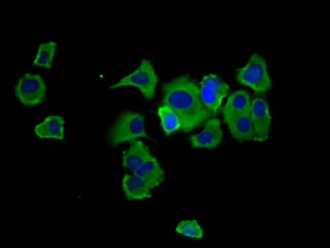 Hepsin Antibody in Immunocytochemistry (ICC/IF)