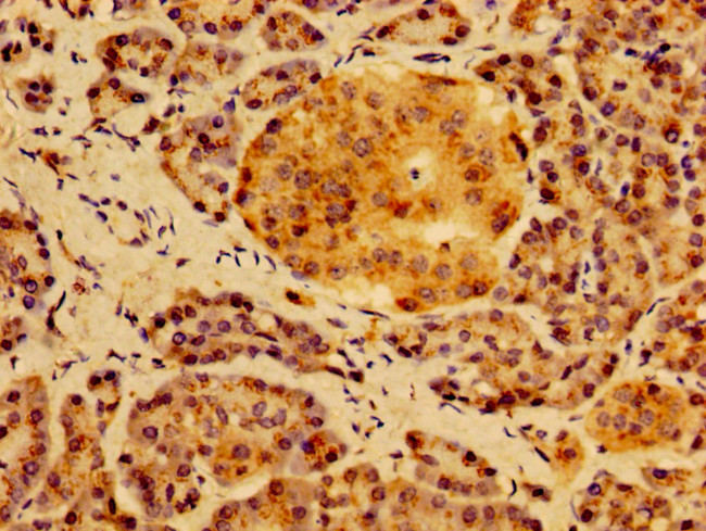 HS2ST1 Antibody in Immunohistochemistry (Paraffin) (IHC (P))
